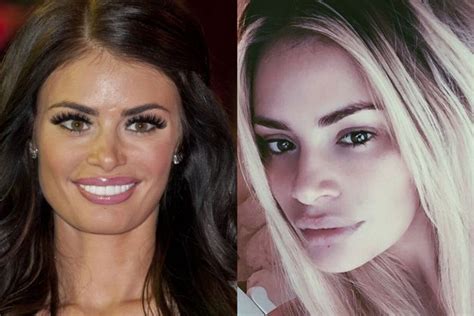 chloe sims face|chloe sims before surgery.